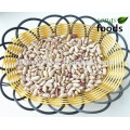 Light Speckled Kidney Beans Long Shape All Variety Beans